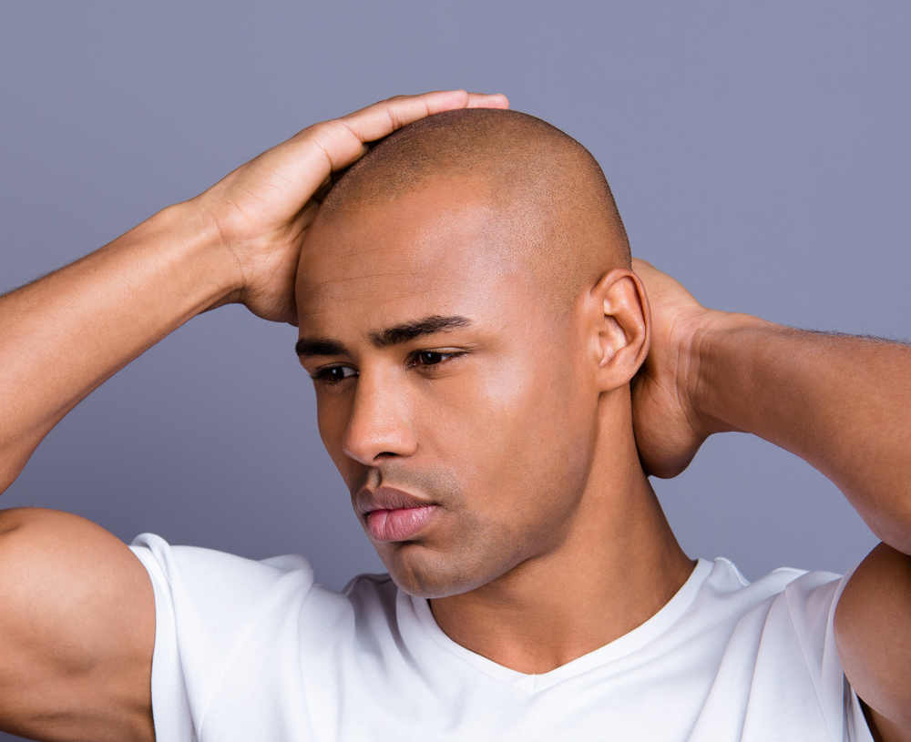 FUE Hair Transplant FAQ