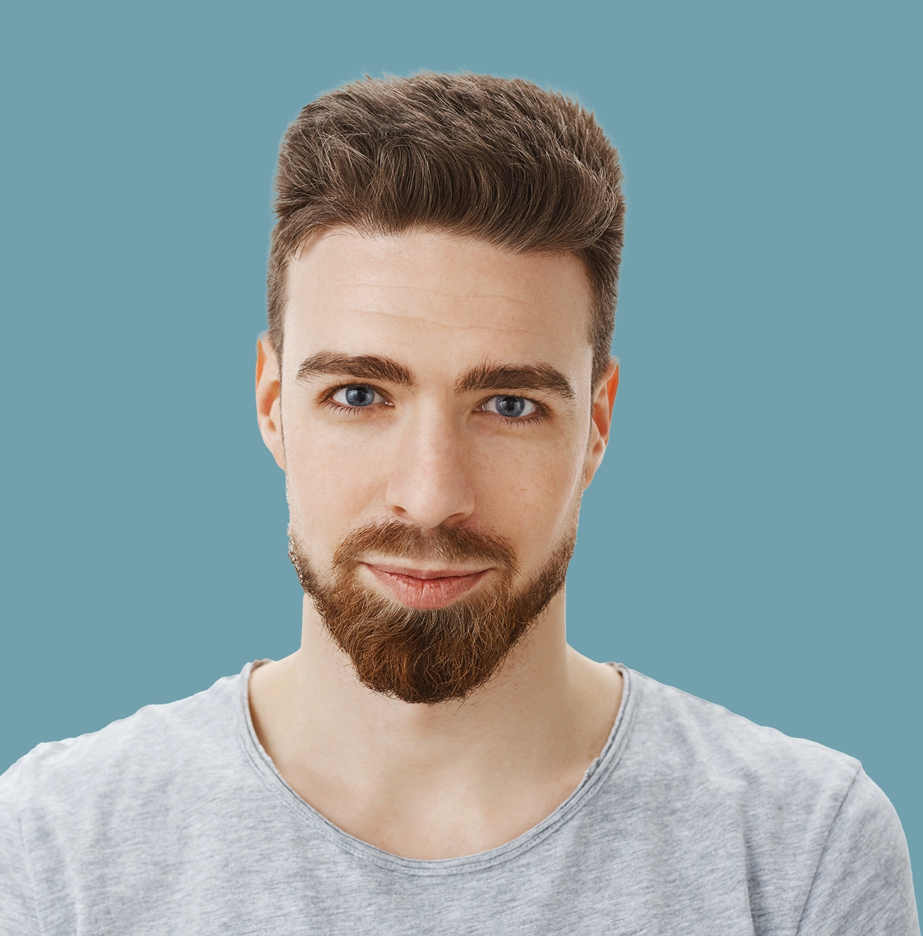 FUE Hair Transplant Biggleswade Aventus Clinic