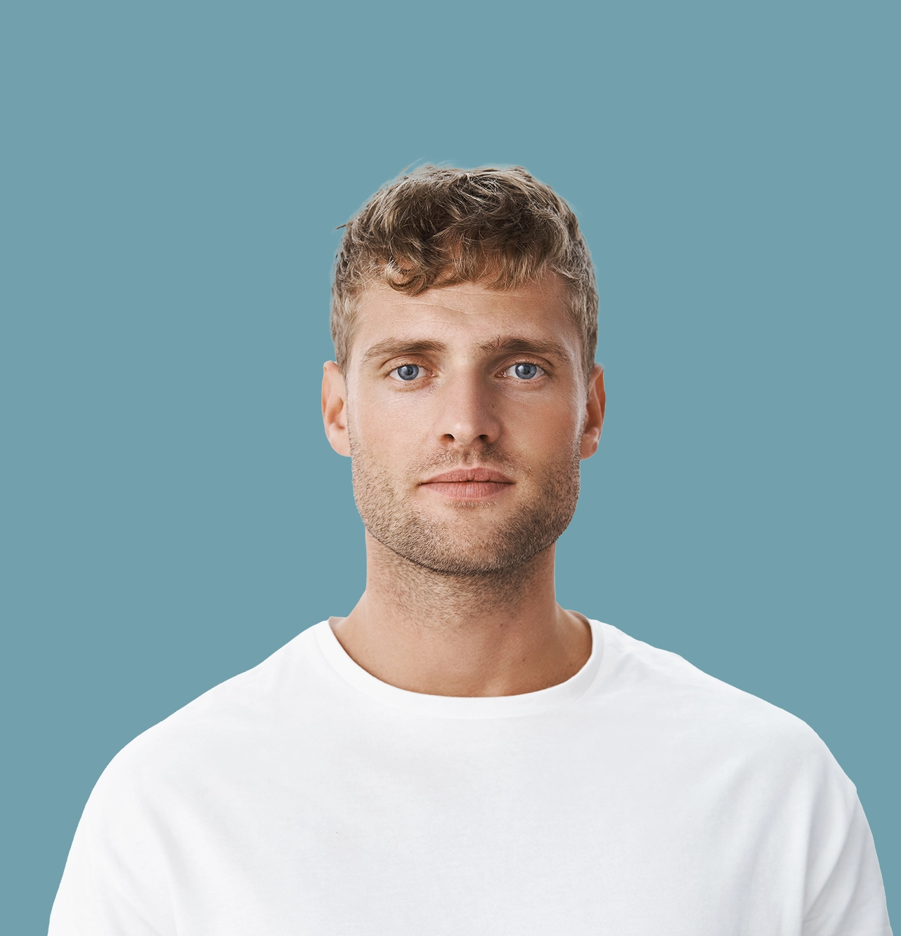 FUE Hair Transplant Leighton Buzzard Aventus Clinic