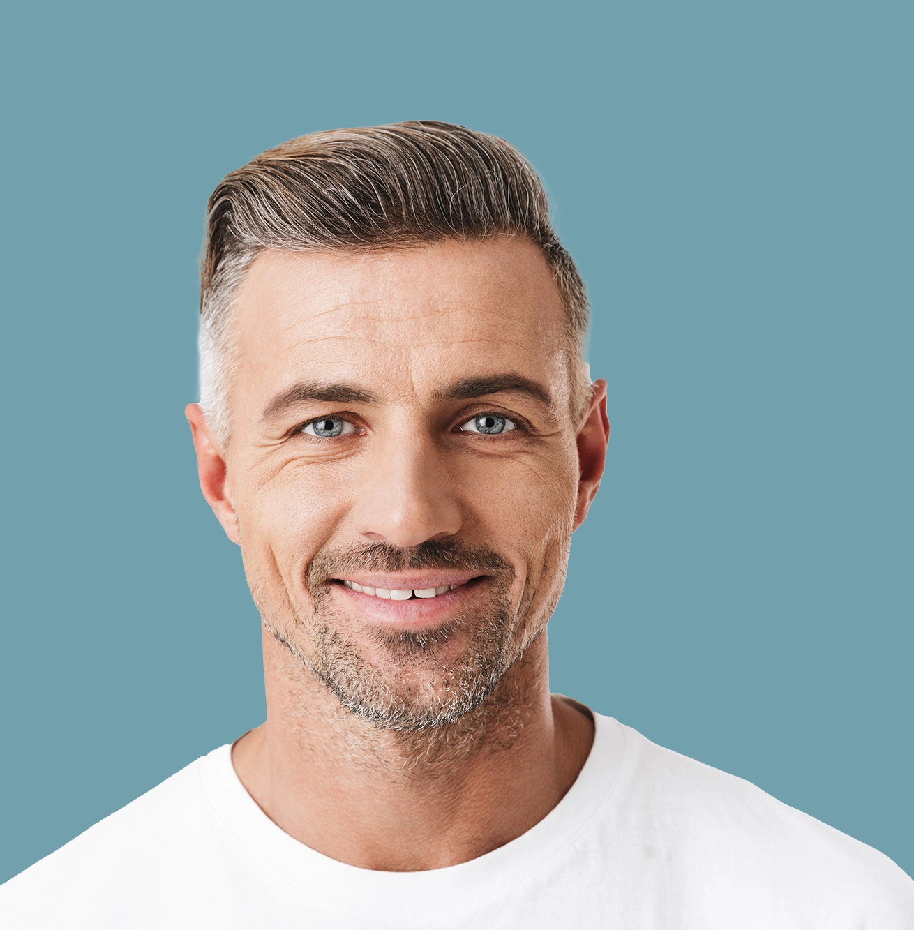 FUE Hair Transplant Welwyn Garden City Aventus Clinic