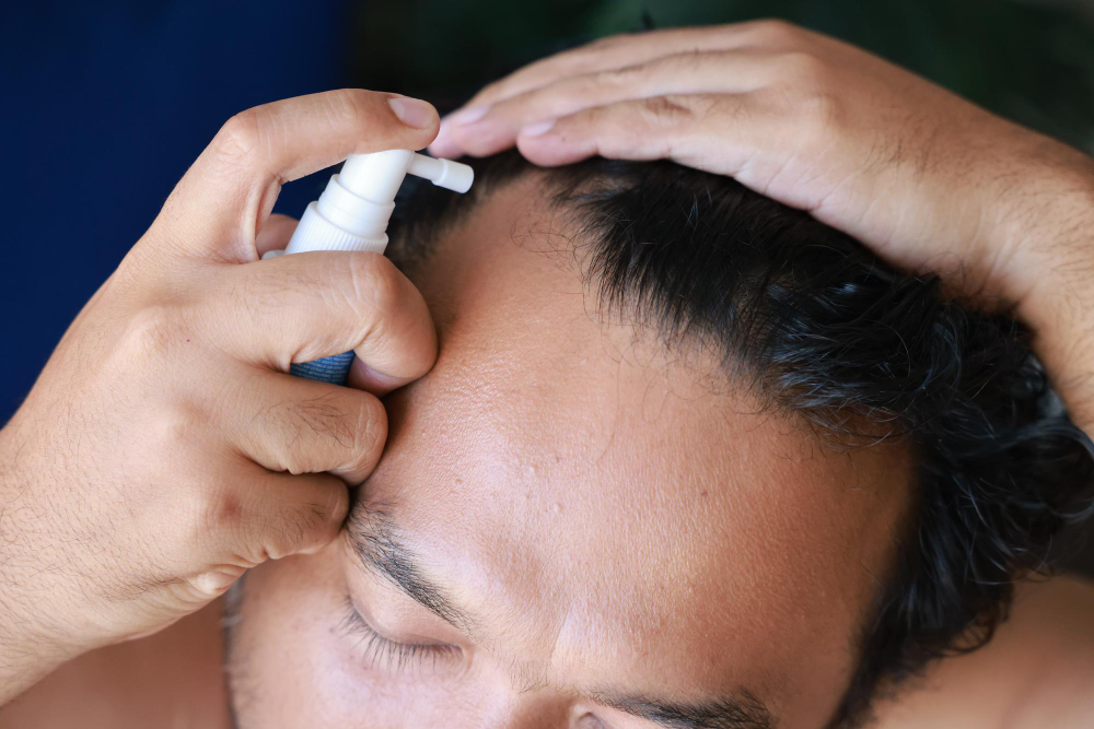 Applying Minoxidil