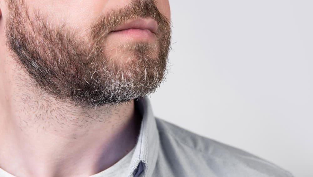 Patchy Beard