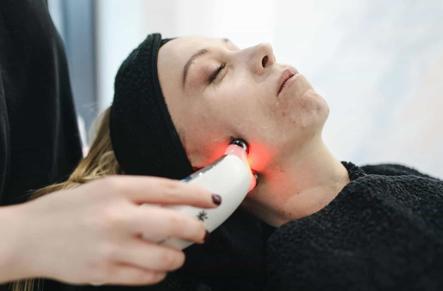 facial laser treatment for acne prone skin