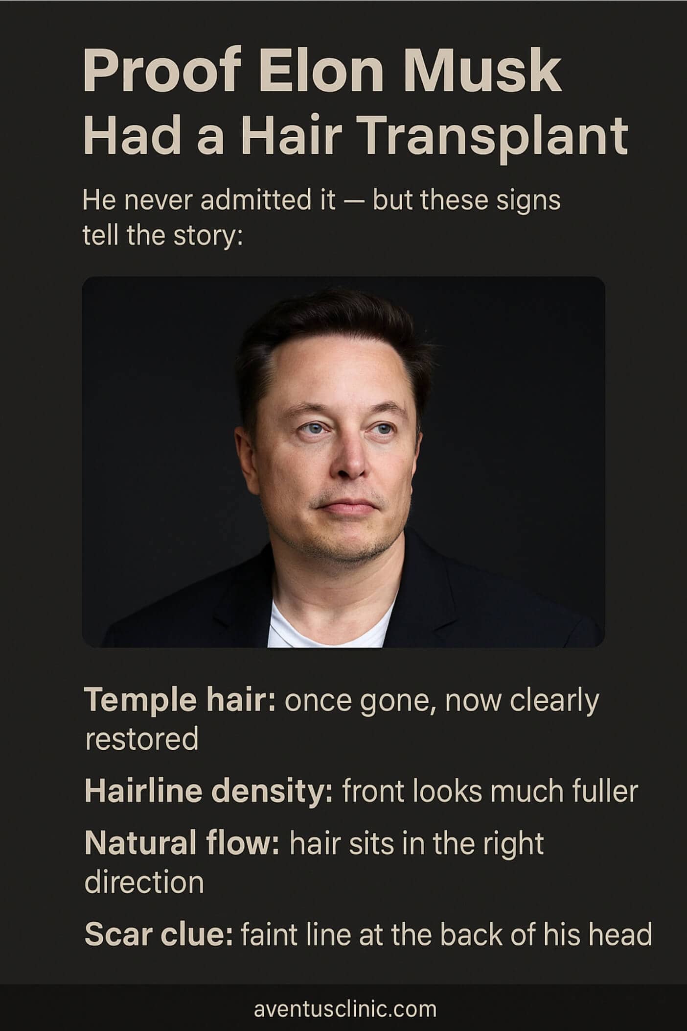 Proof Elon Musk had a hair transplant