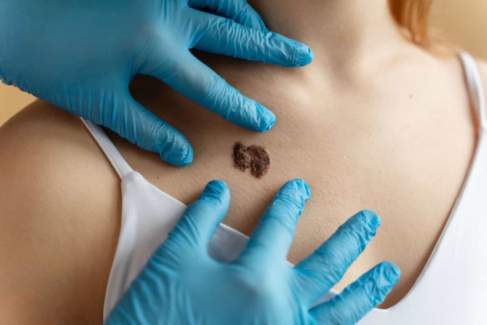 crusty mole