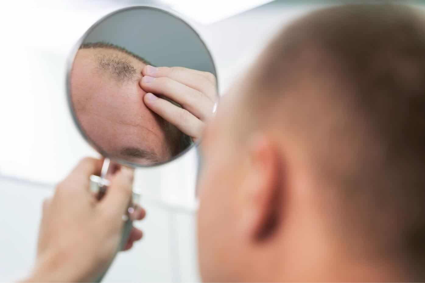 hair patches