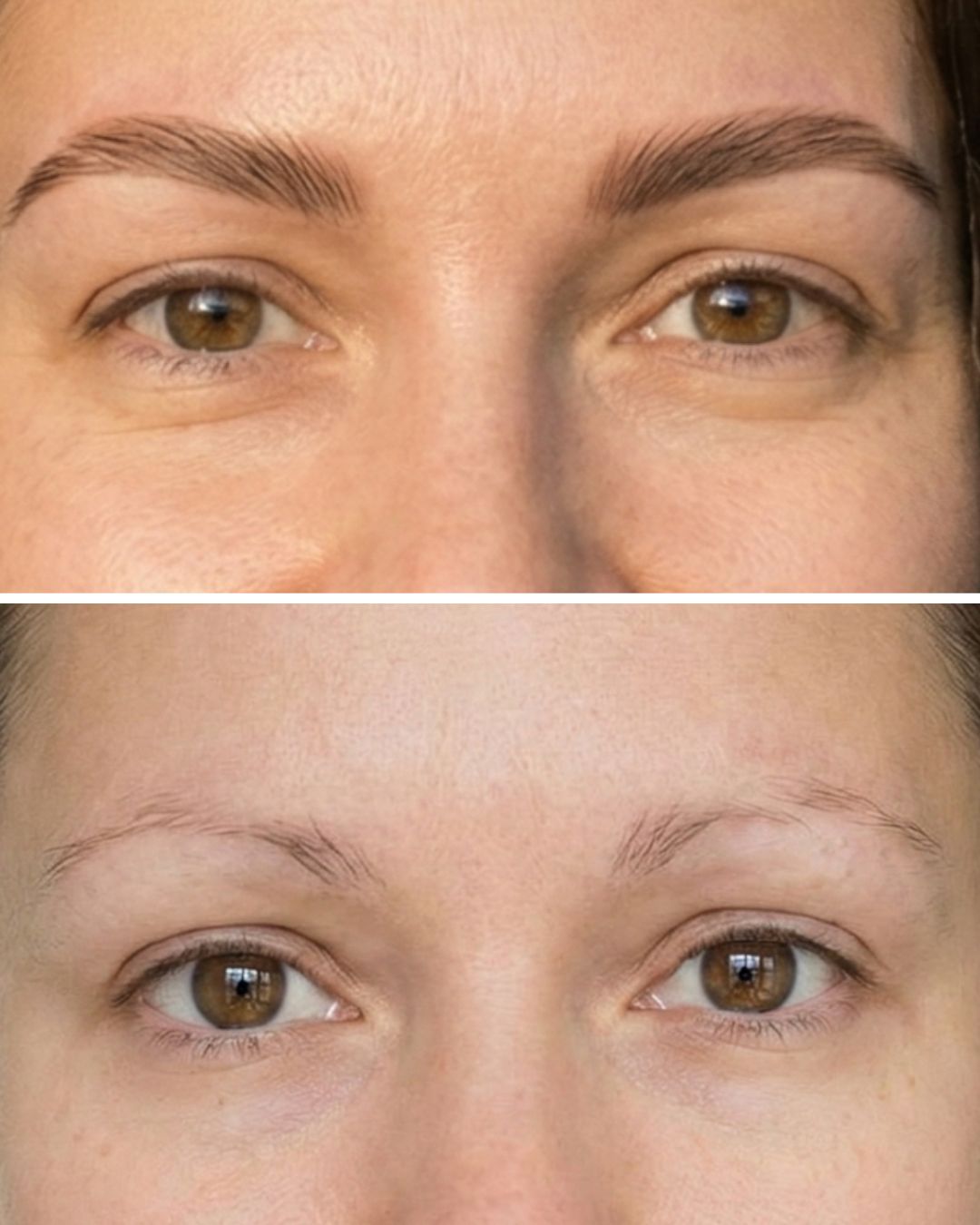 Eyebrow Before and After