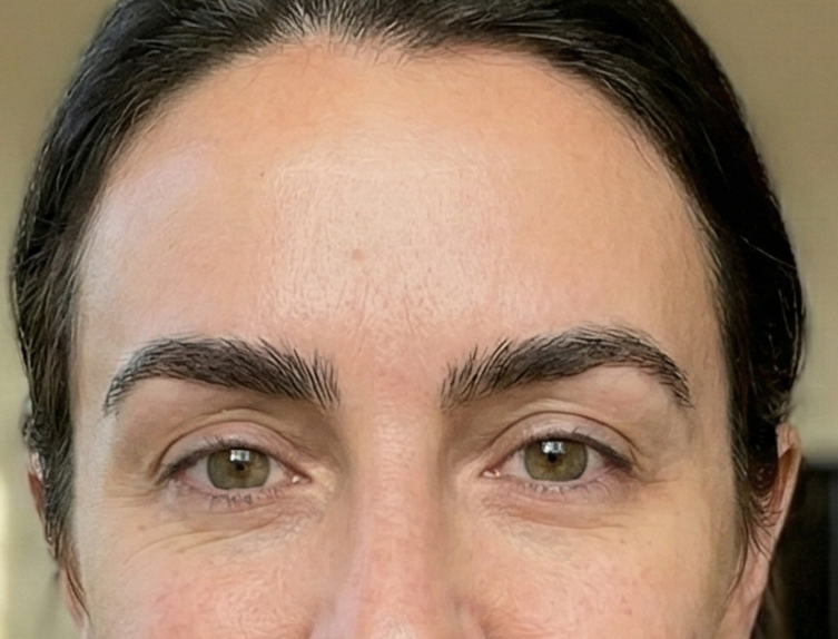eyebrow transplant for men and women