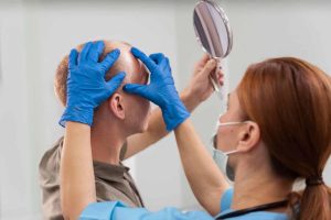 Alopecia Hair Assessment