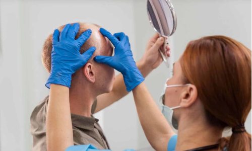 Alopecia Hair Assessment