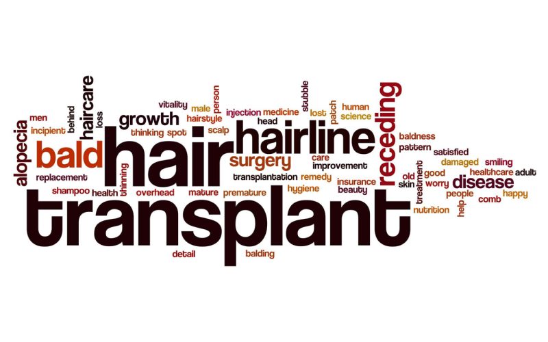 Best-Time-to-Get-a-Hair-Transplant-Treatment