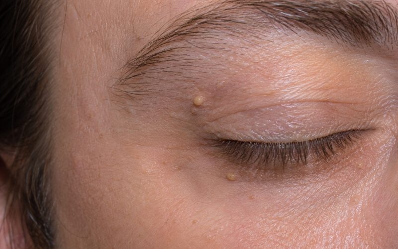 Detailed close-up of eyelid skin