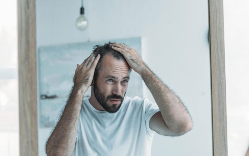 Everything-you-need-to-know-about-hair-loss