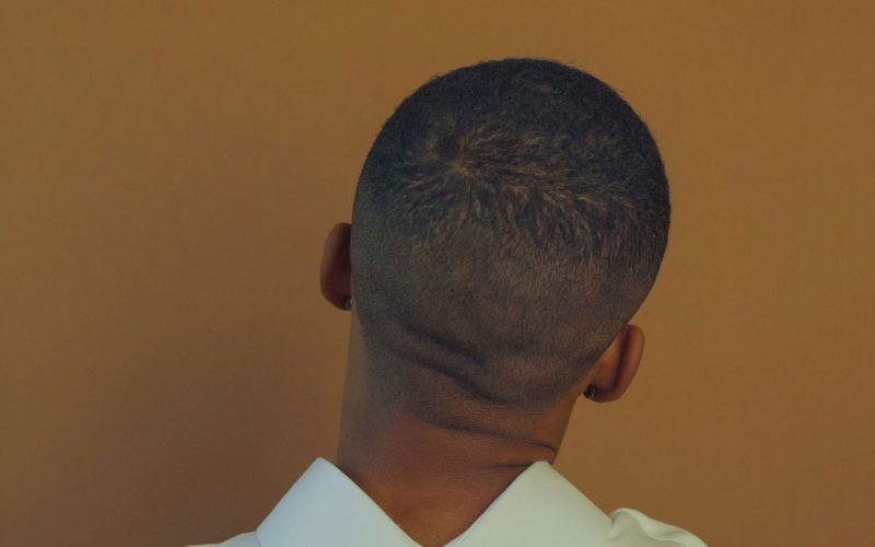 FUE-Hair-Transplant-Aftercare