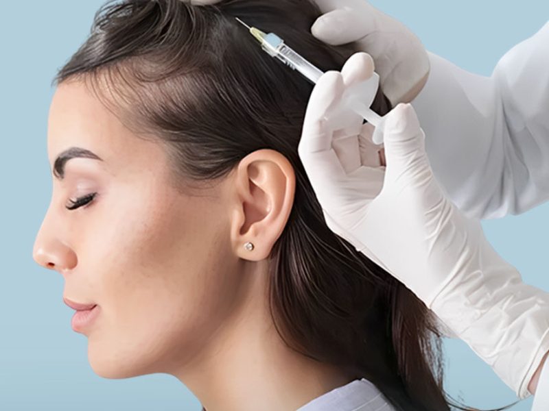 FUE hair transplant for women