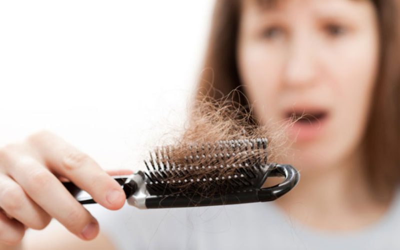 How-to-Prevent-Female-Pattern-Baldness