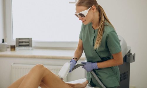 Laser Hair Removal