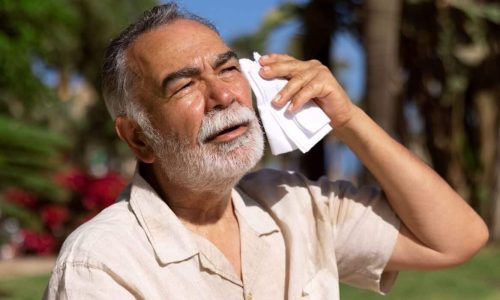UK Skin in hot summers