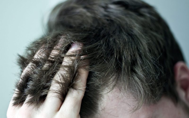 Why-Not-To-Get-a-Hair-Transplant