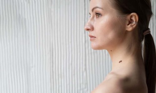 do moles grow back