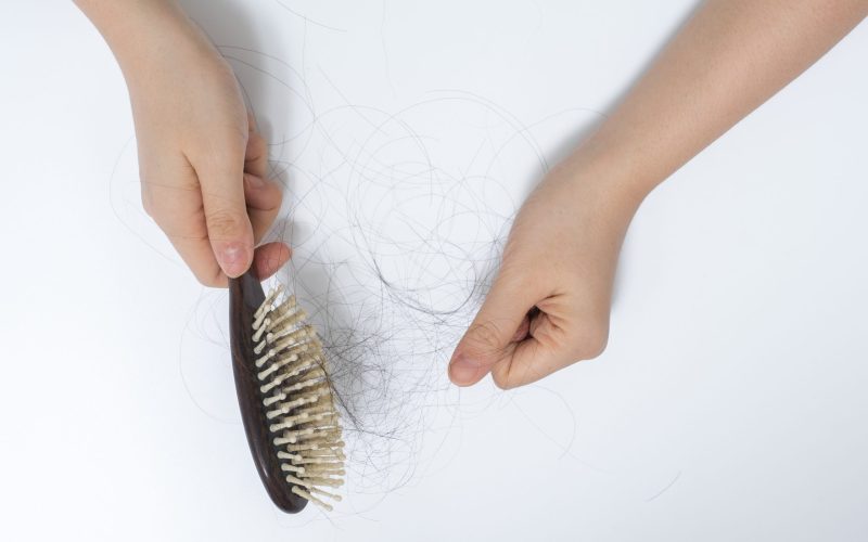 female celebrities hair loss