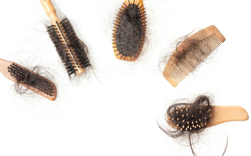 finasteride shedding scaled