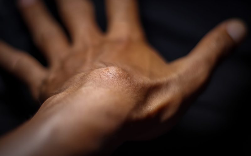 Ganglion Cyst from hard work and painful